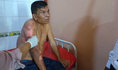 Api Kompor Sambar Tabung Gas, Korban Ansor Siregar Luka Bakar